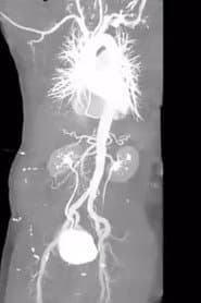 X-Ray Eros